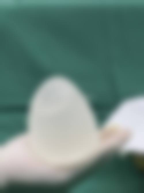 定期复查的重要性