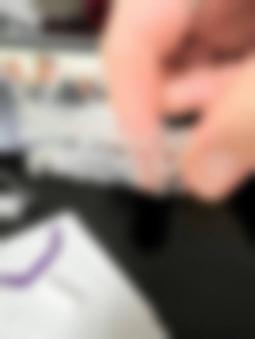 乌鲁木齐牙博士口腔正雅隐形矫正成效：重塑整齐美牙