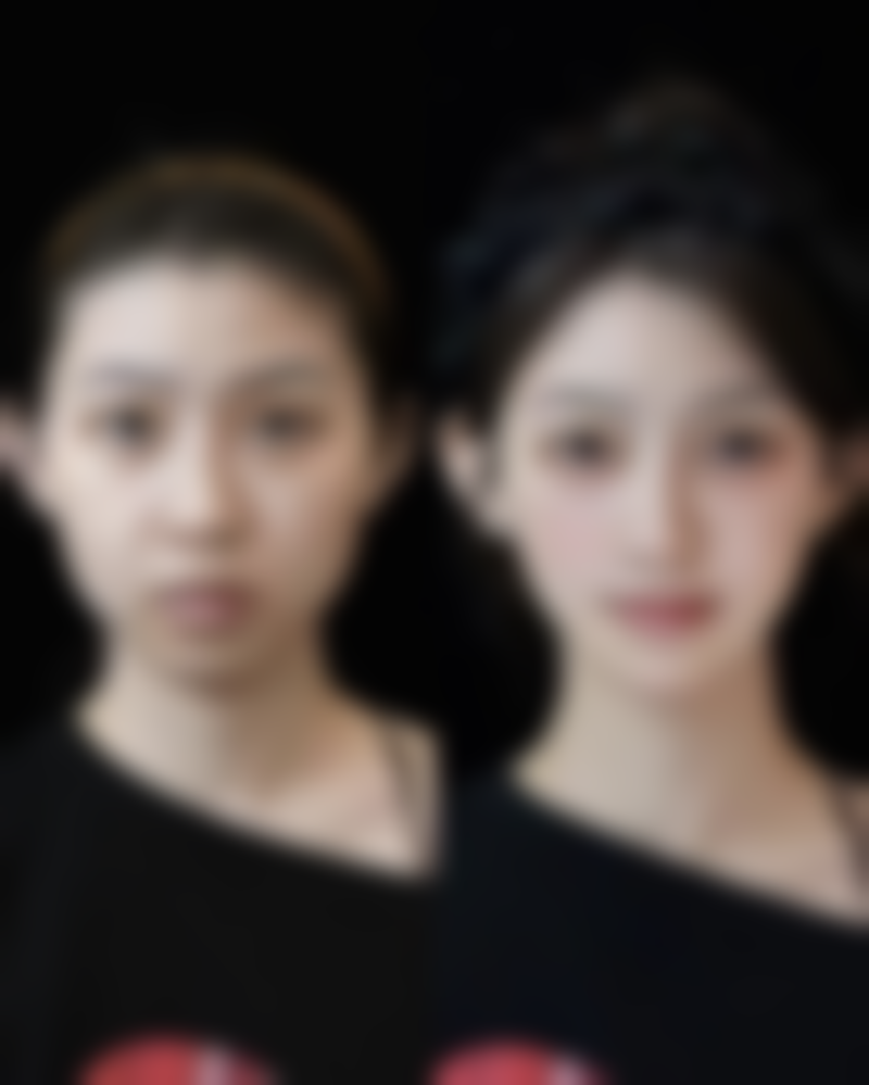 上海华美医美有哪些医生擅长果酸、红蓝光治痘、清痘针项目？