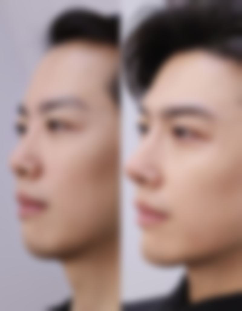 菏泽恩缇医疗美容诊所收费标准参考