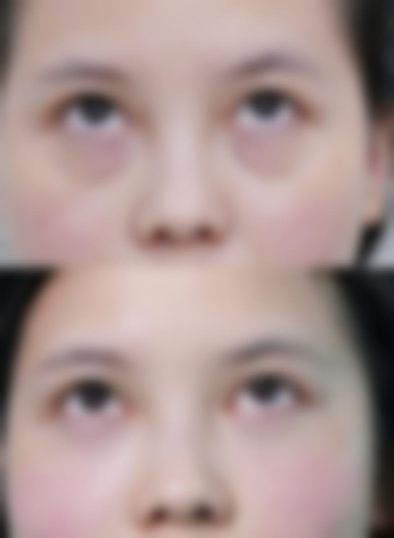 深圳后海安美聚光医疗美容门诊部(南山店)彭喜从医荣誉