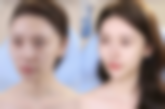 安徽长征微创外科医院整形美容科医院技术好不好？