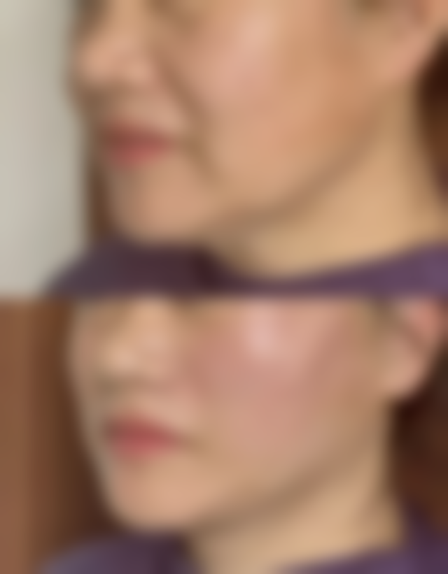 总结——神木刘云霞整形医院怎么样?