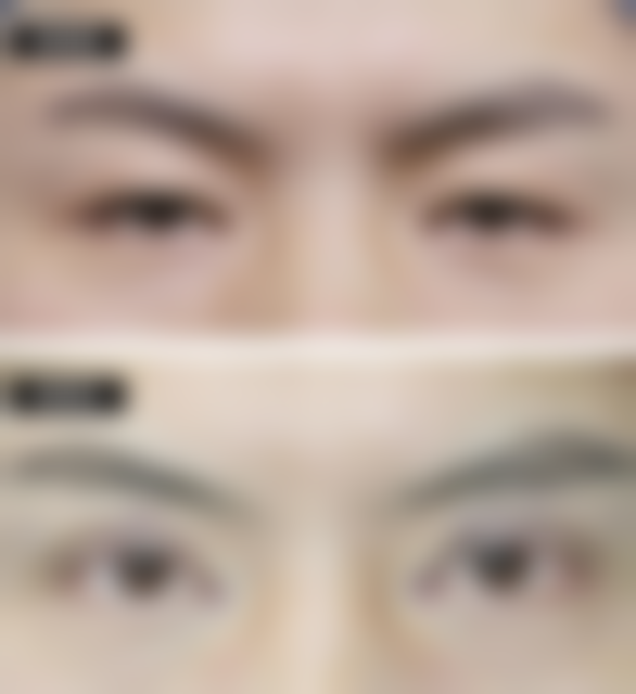 武汉科技大学附属天佑医院(原铁路医院)严玲玲医生技术好不好？