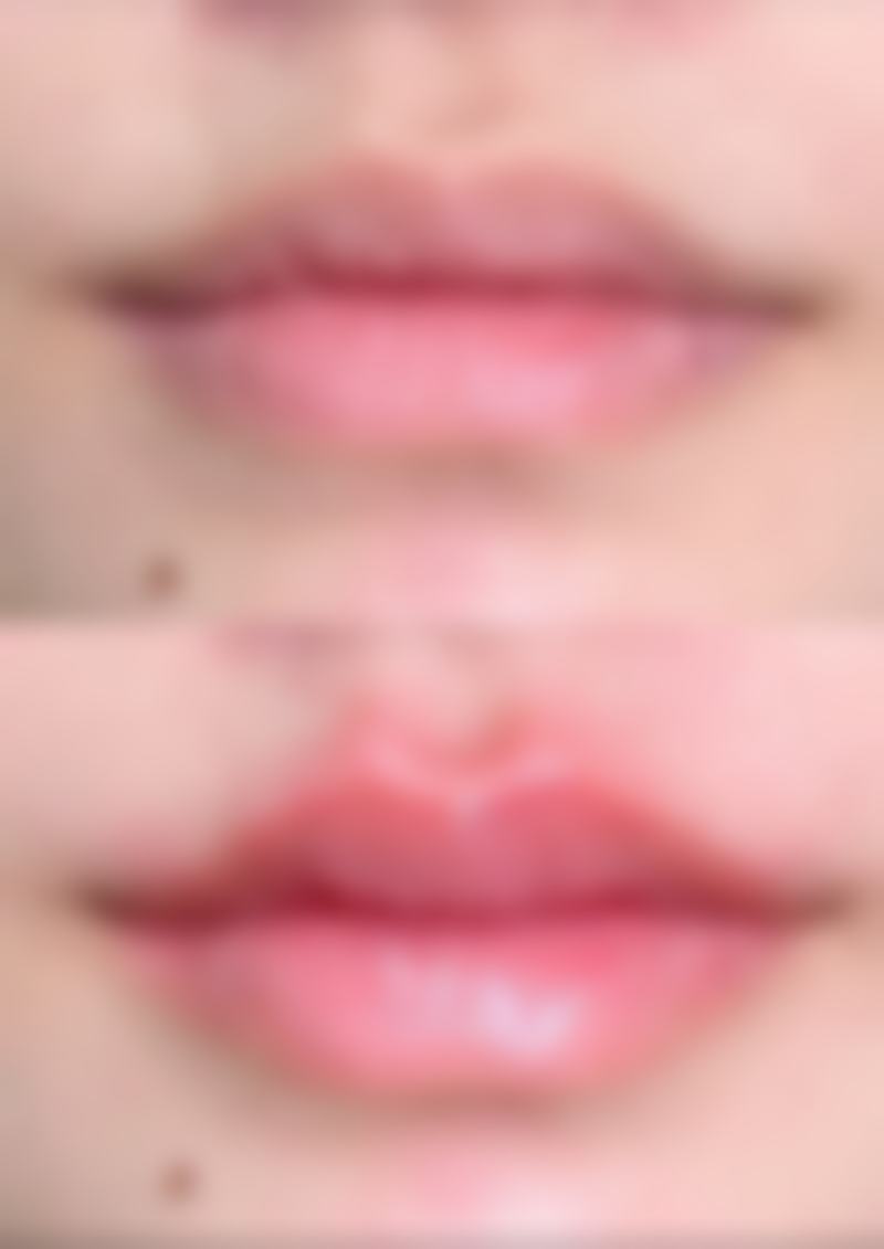 总结——广州丽合整形医院怎么样？