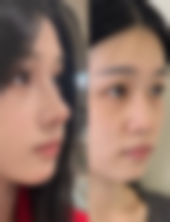 南京晶之悦整形医院医院技术好不好？