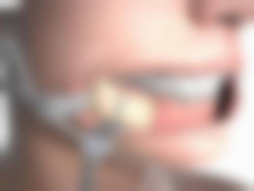 南阳美尔雅整形美容医院口碑如何？