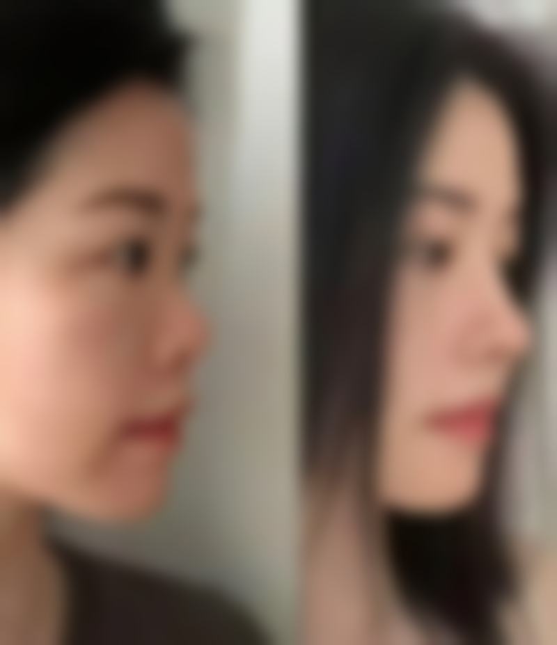 广西柳州解放军158医院整形美容中 心硬件设备精良！