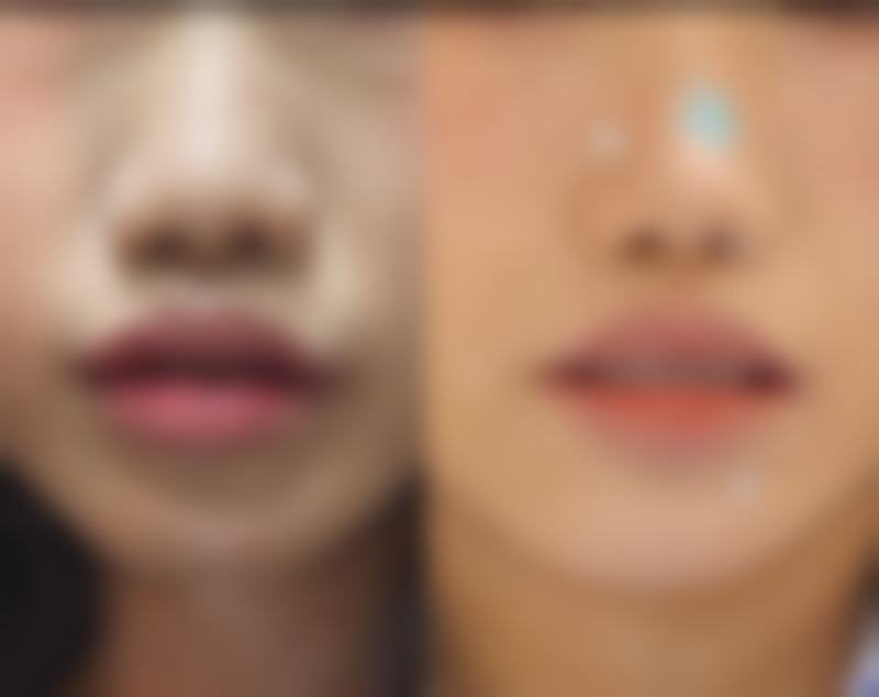 呼和浩特莱美医疗美容医院技术好不好？