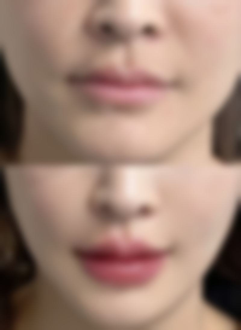 常州薇龄整形医院口碑如何？