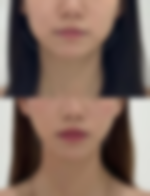 遵义曾斌（青睐）医疗美容诊所医生简介