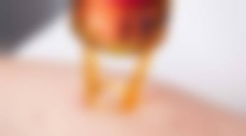 沈阳馨雅医美整形收费标准参考