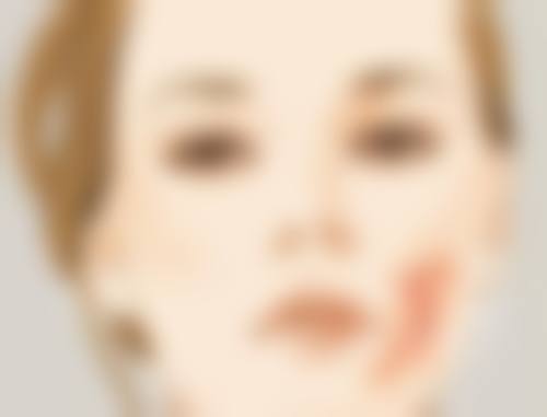 总结——苏州塞莱黄远驰医疗美容诊所怎么样？