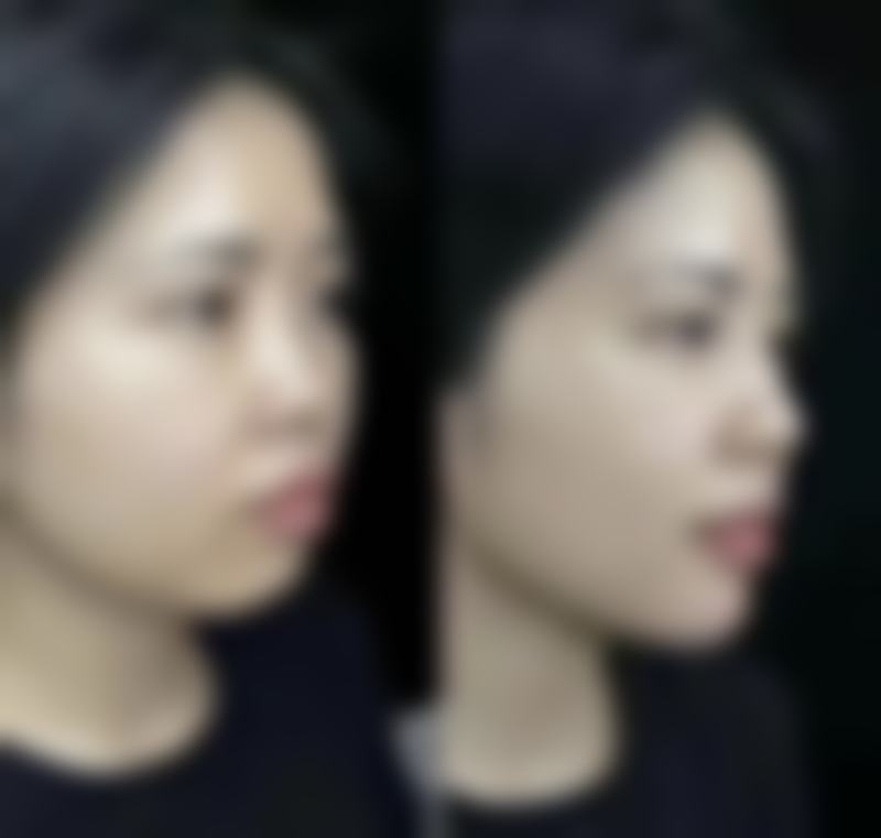 武汉伊美芝医疗美容门诊部医院技术好不好？