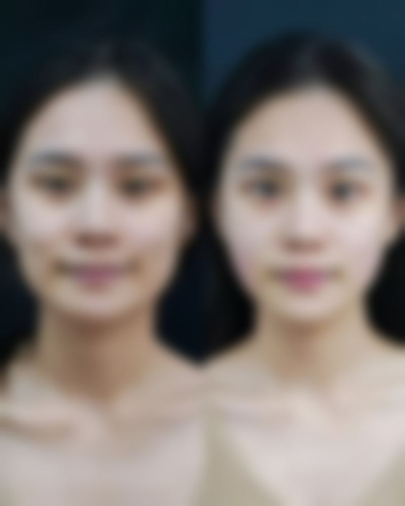 北京永成经典医疗美容硬件设备精良!