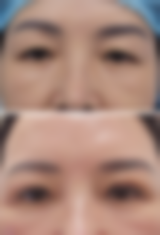 总结——江西省妇幼保健院(医学美容)怎么样？