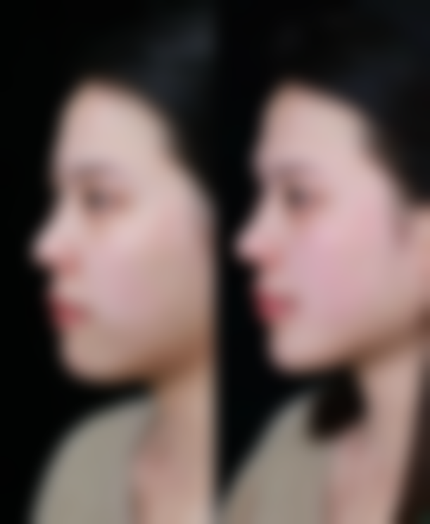 沈阳馨雅医美整形营业时间