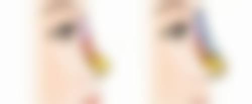 昆山丽星医疗美容门诊部收费标准参考