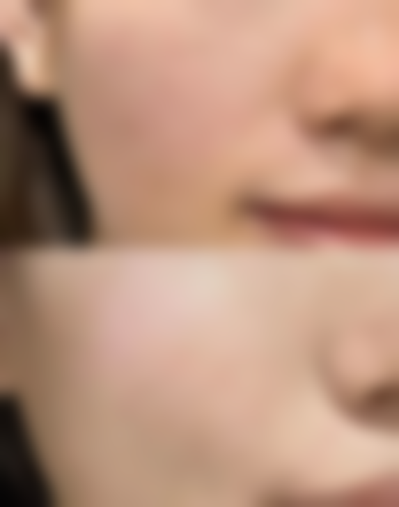 郑州艺龄整形医疗美容诊所口碑如何？