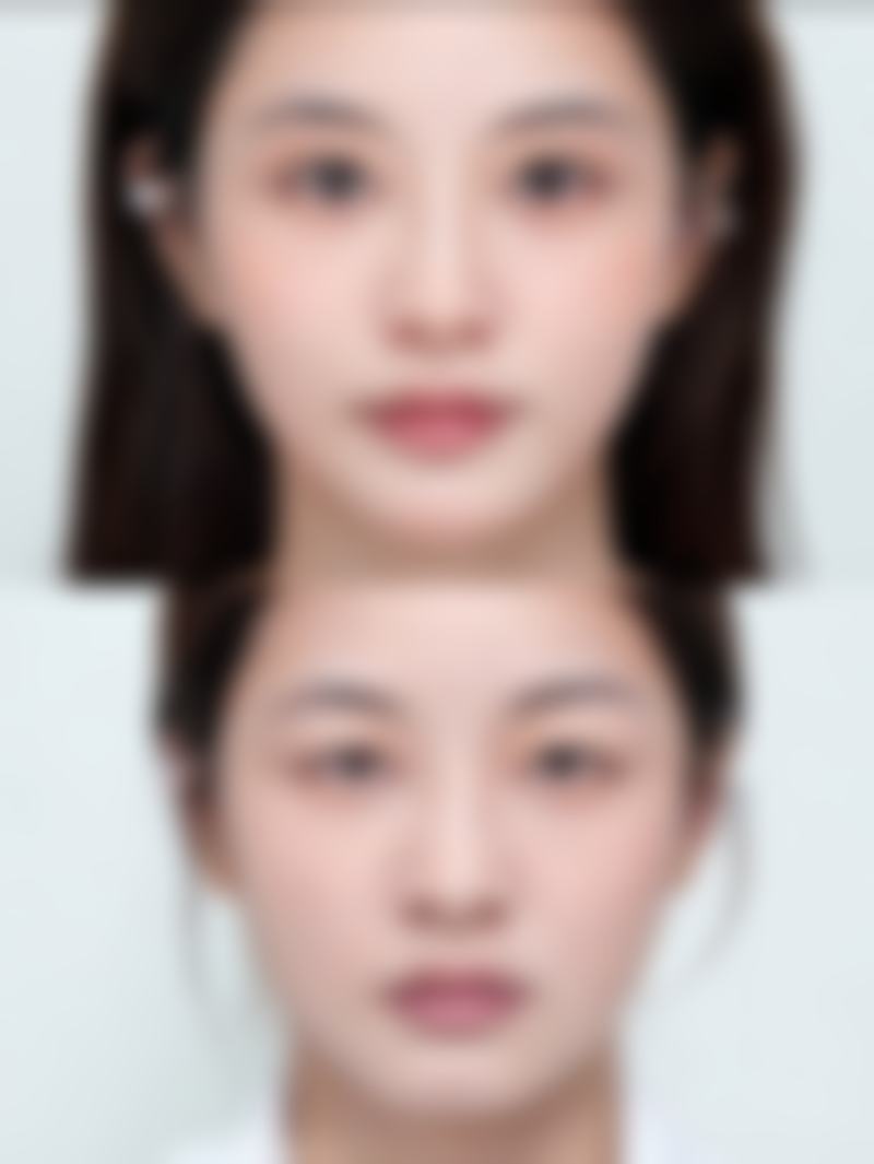 深圳妍幂整形医院硬件设备精良！