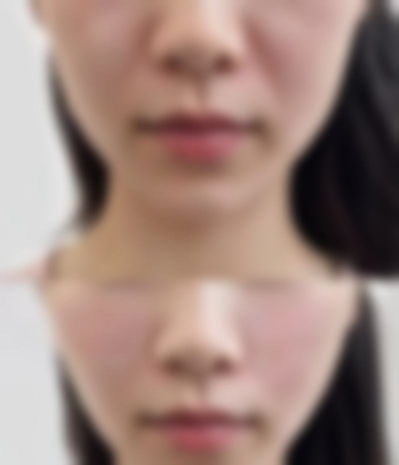 福州市鼓楼区名韩整形医疗美容医院硬件设备精良！