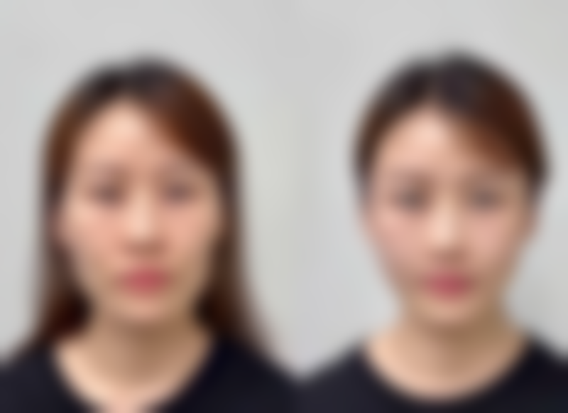 郑州艺龄整形医疗美容诊所医院技术好不好？