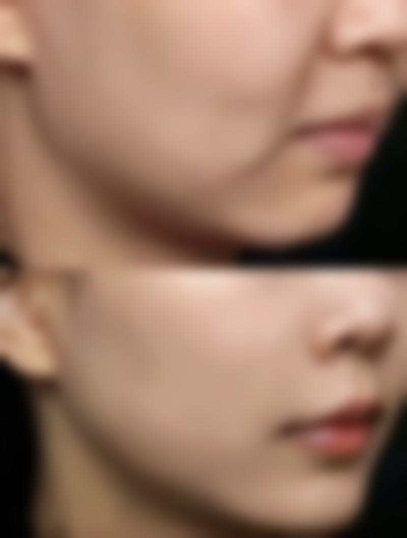 福州市鼓楼区名韩整形医疗美容医院技术好不好？