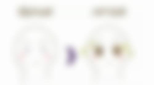 自体脂肪丰太阳穴的术后护理