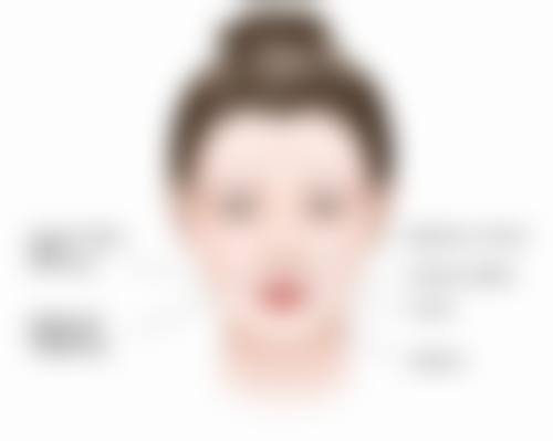 小腿吸脂手术有什么危害？感染、皮肤问题、神经损伤等风险你了解吗