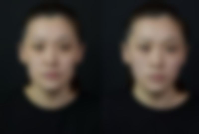 咸阳长城医院美容整形科医院技术好不好？