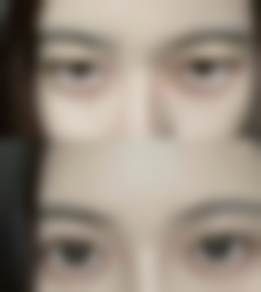 宿州市汉密尔顿医学美容整形收费标准参考