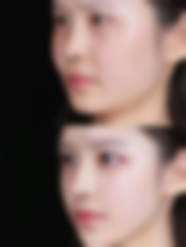 海南优嘉舒颜医疗美容诊所庄静玲医生挂号预约攻略