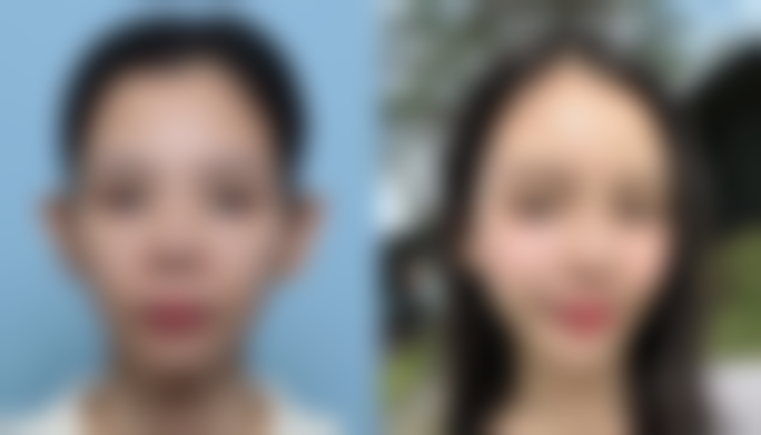 总结——广西北海韩美整形怎么样？