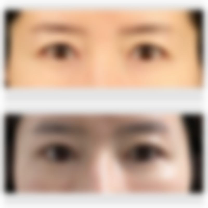 海南优嘉舒颜医疗美容诊所庄静玲医生口碑评价如何？