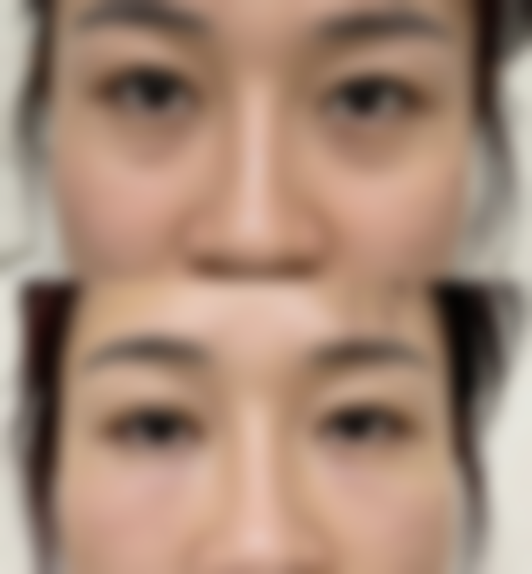 山东菏泽巨野人民医院整形外科地址