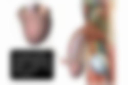 毛囊种植的方式