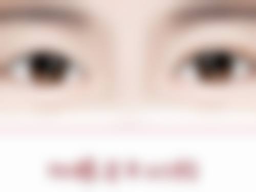 海南优嘉舒颜医疗美容诊所庄静玲医生技术好不好？