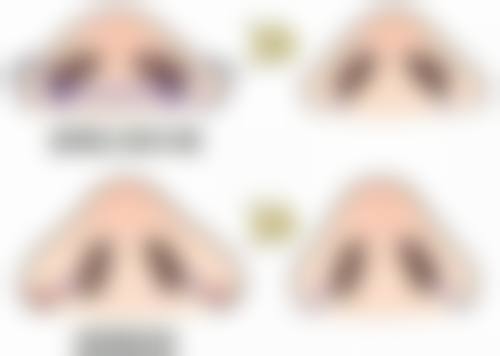 奥美定隆鼻形成硬结的原因是什么