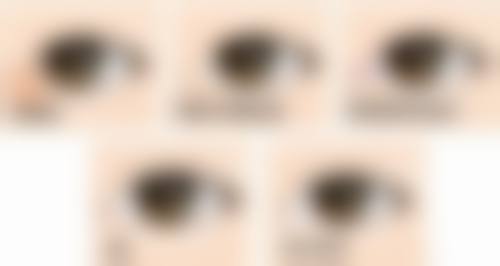 毛囊提取的方法