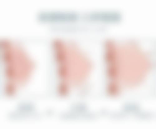 总结——海南优嘉舒颜医疗美容诊所庄静玲医生怎么样？