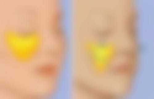 长期黑眼圈眼袋怎么消？日常护理、医美手段双管齐下助你告别熊猫眼和大眼袋