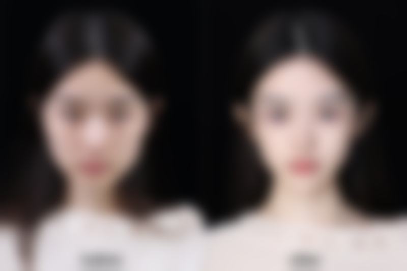 柳州贞韩医疗美容诊所植发科口碑如何？