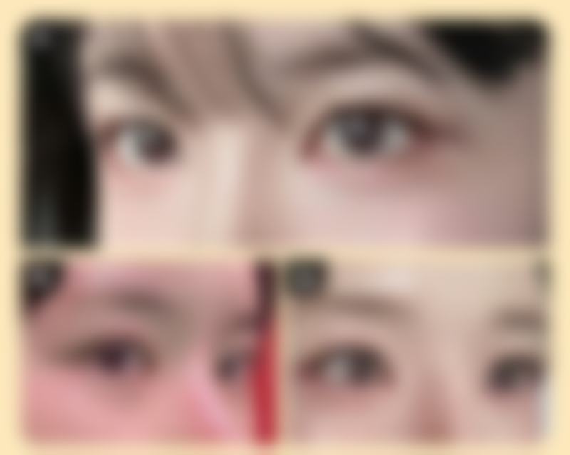 注射瘦脸针的价格大概是多少