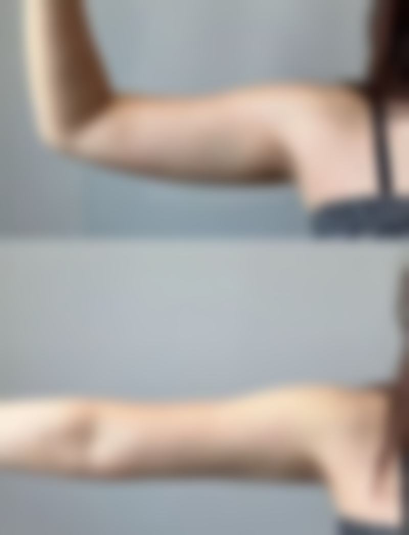 韩国柔欣爱牙科美容整形科医院技术好不好？