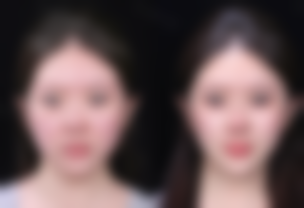 总结——海南优嘉舒颜医疗美容诊所庄静玲医生怎么样？