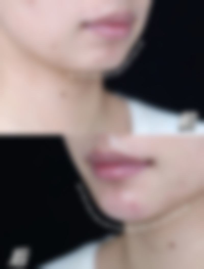 柳州贞韩医疗美容诊所植发科地址