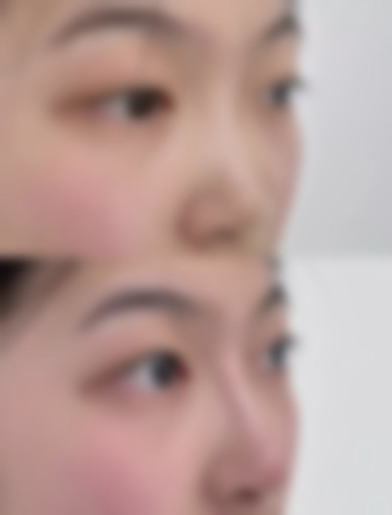 郑州合熙召香整形医院口碑如何？