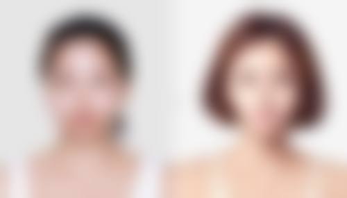 温岭壹臣医疗美容门诊部收费标准参考