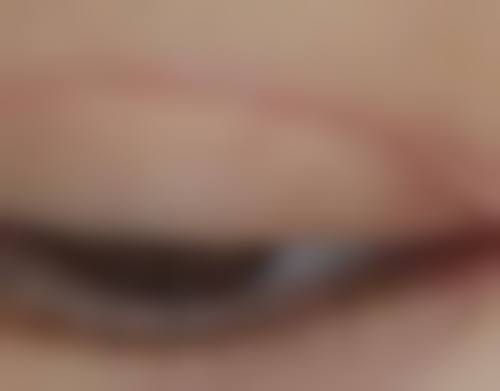 西双版纳旭美整形医疗美容门诊部医院技术好不好?