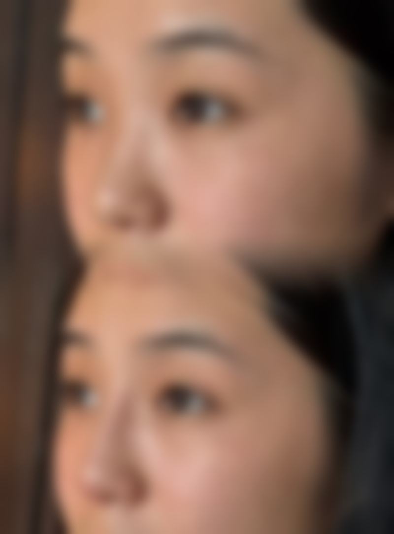 红河悦她婕熹卡医疗美容诊所医院技术好不好？